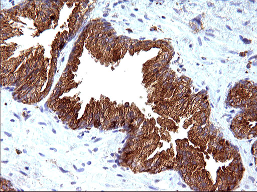 SCAMP2 Antibody - IHC of paraffin-embedded Human prostate tissue using anti-SCAMP2 mouse monoclonal antibody. (Heat-induced epitope retrieval by 10mM citric buffer, pH6.0, 120°C for 3min).