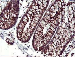 SCAMP2 Antibody - IHC of paraffin-embedded Human colon tissue using anti-SCAMP2 mouse monoclonal antibody. (Heat-induced epitope retrieval by 10mM citric buffer, pH6.0, 120°C for 3min).
