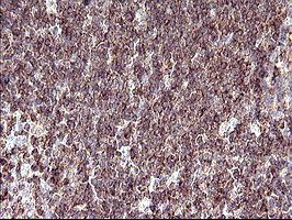 SCAMP2 Antibody - IHC of paraffin-embedded Human lymph node tissue using anti-SCAMP2 mouse monoclonal antibody. (Heat-induced epitope retrieval by 10mM citric buffer, pH6.0, 120°C for 3min).