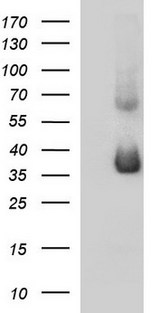 SCAMP2 Antibody - HEK293T cells were transfected with the pCMV6-ENTRY control (Left lane) or pCMV6-ENTRY SCAMP2 (Right lane) cDNA for 48 hrs and lysed. Equivalent amounts of cell lysates (5 ug per lane) were separated by SDS-PAGE and immunoblotted with anti-SCAMP2.