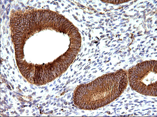SCAMP2 Antibody - IHC of paraffin-embedded Human endometrium tissue using anti-SCAMP2 mouse monoclonal antibody. (Heat-induced epitope retrieval by 10mM citric buffer, pH6.0, 120°C for 3min).
