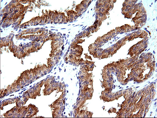 SCAMP2 Antibody - IHC of paraffin-embedded Human prostate tissue using anti-SCAMP2 mouse monoclonal antibody. (Heat-induced epitope retrieval by 10mM citric buffer, pH6.0, 120°C for 3min).