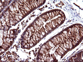SCAMP2 Antibody - IHC of paraffin-embedded Human colon tissue using anti-SCAMP2 mouse monoclonal antibody. (Heat-induced epitope retrieval by 10mM citric buffer, pH6.0, 120°C for 3min).