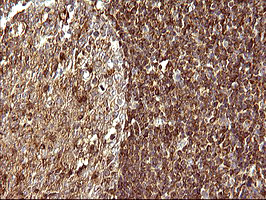 SCAMP2 Antibody - IHC of paraffin-embedded Human lymph node tissue using anti-SCAMP2 mouse monoclonal antibody. (Heat-induced epitope retrieval by 10mM citric buffer, pH6.0, 120°C for 3min).