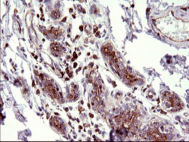 SCAMP2 Antibody - IHC of paraffin-embedded Human breast tissue using anti-SCAMP2 mouse monoclonal antibody. (Heat-induced epitope retrieval by 10mM citric buffer, pH6.0, 120°C for 3min).