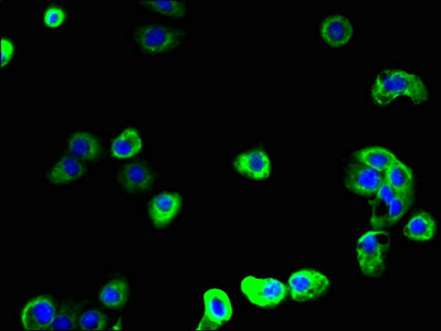 SCAMP2 Antibody - Immunofluorescent analysis of A431 cells using SCAMP2 Antibody at dilution of 1:100 and Alexa Fluor 488-congugated AffiniPure Goat Anti-Rabbit IgG(H+L)
