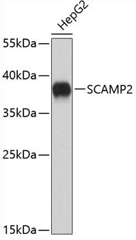 SCAMP2 Antibody - Western blot analysis of extracts of HepG2 cells using SCAMP2 Polyclonal Antibody.