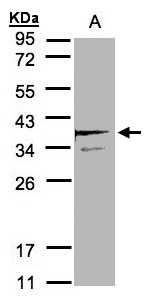 SCAMP3 Antibody - Sample (30 ug of whole cell lysate). A: MOLT4. 12% SDS PAGE. SCAMP3 antibody diluted at 1:2000