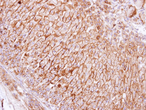 SCAMP3 Antibody - IHC of paraffin-embedded adrenal gland using SCAMP3 antibody at 1:100 dilution.