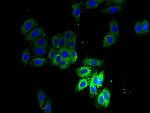 SCAMP3 Antibody - Immunofluorescent analysis of HepG2 cells using SCAMP3 Antibody at a dilution of 1:100 and Alexa Fluor 488-congugated AffiniPure Goat Anti-Rabbit IgG(H+L).  This image was taken for the unconjugated form of this product. Other forms have not been tested.