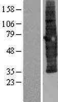 SCAMP3 Protein - Western validation with an anti-DDK antibody * L: Control HEK293 lysate R: Over-expression lysate