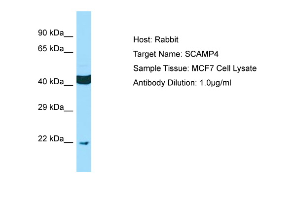 SCAMP4 Antibody -  This image was taken for the unconjugated form of this product. Other forms have not been tested.