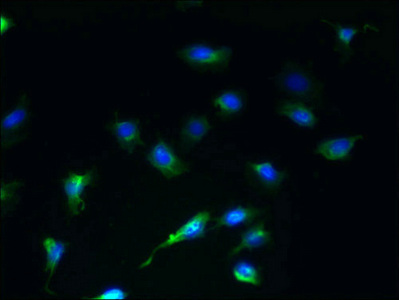SCAMP4 Antibody - Immunofluorescent analysis of U251 cells using SCAMP4 Antibody at dilution of 1:100 and Alexa Fluor 488-congugated AffiniPure Goat Anti-Rabbit IgG(H+L)