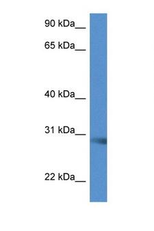 SCAMP5 Antibody - SCAMP5 antibody Western blot of Mouse Liver lysate. Antibody concentration 1 ug/ml.  This image was taken for the unconjugated form of this product. Other forms have not been tested.