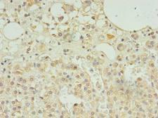 SCAMP5 Antibody - Immunohistochemistry of paraffin-embedded human adrenal gland tissue using antibody at dilution of 1:100.