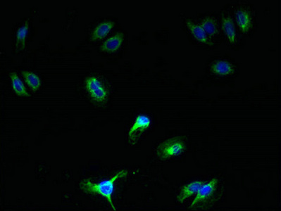 SCAMP5 Antibody - Immunofluorescent analysis of HepG2 cells using SCAMP5 Antibody at dilution of 1:100 and Alexa Fluor 488-congugated AffiniPure Goat Anti-Rabbit IgG(H+L)