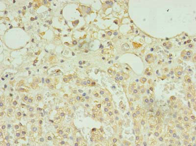 SCAMP5 Antibody - Immunohistochemistry of paraffin-embedded human adrenal gland tissue using SCAMP5 Antibody at dilution of 1:100