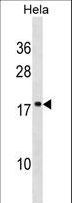 SCAND1 Antibody - SCAND1 Antibody western blot of HeLa cell line lysates (35 ug/lane). The SCAND1 antibody detected the SCAND1 protein (arrow).