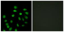 SCAND1 Antibody - Immunofluorescence analysis of HepG2 cells, using SCAND1 Antibody. The picture on the right is blocked with the synthesized peptide.