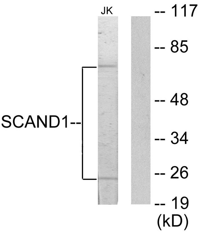 SCAND1 Antibody - Western blot analysis of lysates from Jurkat cells, using SCAND1 Antibody. The lane on the right is blocked with the synthesized peptide.