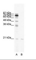SCAND1 Antibody - A: Marker, B: HepG2 Cell Lysate.  This image was taken for the unconjugated form of this product. Other forms have not been tested.