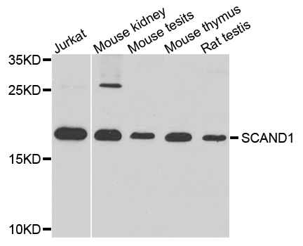 SCAND1 Antibody - Western blot analysis of extract of various cells.