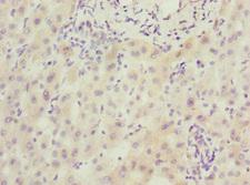 SCAND1 Antibody - Immunohistochemistry of paraffin-embedded human liver cancer at dilution 1:100