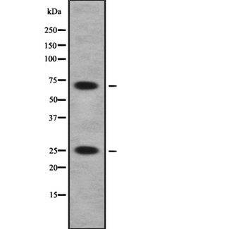 SCAND1 Antibody - Western blot analysis SCAND1 using Jurkat whole cells lysates