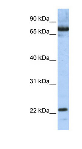SCAND1 Antibody - SCAND1 antibody Western blot of Jurkat lysate. This image was taken for the unconjugated form of this product. Other forms have not been tested.