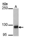 SCAP Antibody - Sample (30 ug of whole cell lysate). A: Hep G2. 5% SDS PAGE. SCAP antibody diluted at 1:5000