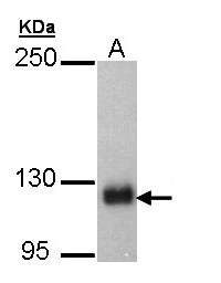 SCAP Antibody - Sample (30 ug of whole cell lysate). A: Hep G2. 5% SDS PAGE. SCAP antibody diluted at 1:5000