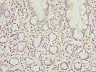 SCAPER Antibody - Immunohistochemistry of paraffin-embedded human small intestine tissue using antibody at dilution of 1:100.