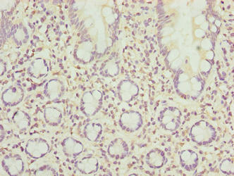 SCAPER Antibody - Immunohistochemistry of paraffin-embedded human small intestine tissue using SCAPER Antibody at dilution of 1:100