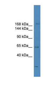 SCAPER Antibody - SCAPER antibody Western blot of ACHN lysate. This image was taken for the unconjugated form of this product. Other forms have not been tested.