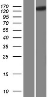 SCAPER Protein - Western validation with an anti-DDK antibody * L: Control HEK293 lysate R: Over-expression lysate
