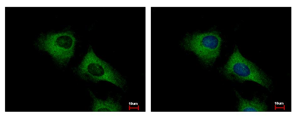 SCARA3 / APC7 Antibody - SCARA3 antibody [N2C2], Internal detects SCARA3 protein at cytoplasm by immunofluorescent analysis. HeLa cells were fixed in -20 100% MeOH for 5 min. SCARA3 protein stained by SCARA3 antibody [N2C2], Internal diluted at 1:500. 