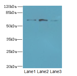 SCARA3 / APC7 Antibody - Western blot. All lanes: SCARA3 antibody at 0.8 ug/ml. Lane 1: Mouse liver tissue. Lane 2: Mouse kidney tissue. Lane 3: A549 whole cell lysate. Secondary Goat polyclonal to Rabbit IgG at 1:10000 dilution. Predicted band size: 65 kDa. Observed band size: 65 kDa.
