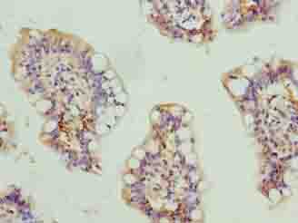 SCARA3 / APC7 Antibody - Immunohistochemistry of paraffin-embedded human small intestine tissue using antibody at dilution of 1:100.