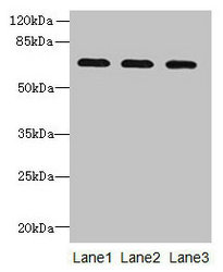 SCARA3 / APC7 Antibody - Western blot All lanes: SCARA3 antibody at 0.8µg/ml Lane 1: Mouse liver tissue Lane 2: Mouse kidney tissue Lane 3: A549 whole cell lysate Secondary Goat polyclonal to rabbit IgG at 1/10000 dilution Predicted band size: 66, 53 kDa Observed band size: 66 kDa