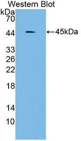 SCARA5 Antibody - Western blot of SCARA5 antibody.