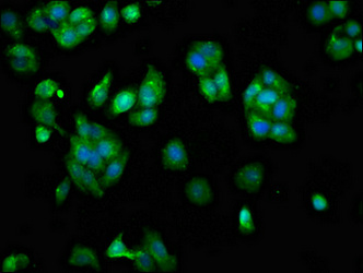 SCARA5 Antibody - Immunofluorescence staining of HepG2 cells at a dilution of 1:133, counter-stained with DAPI. The cells were fixed in 4% formaldehyde, permeabilized using 0.2% Triton X-100 and blocked in 10% normal Goat Serum. The cells were then incubated with the antibody overnight at 4 °C.The secondary antibody was Alexa Fluor 488-congugated AffiniPure Goat Anti-Rabbit IgG (H+L) .