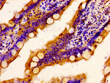 SCARA5 Antibody - Immunohistochemistry image at a dilution of 1:400 and staining in paraffin-embedded human small intestine tissue performed on a Leica BondTM system. After dewaxing and hydration, antigen retrieval was mediated by high pressure in a citrate buffer (pH 6.0) . Section was blocked with 10% normal goat serum 30min at RT. Then primary antibody (1% BSA) was incubated at 4 °C overnight. The primary is detected by a biotinylated secondary antibody and visualized using an HRP conjugated SP system.