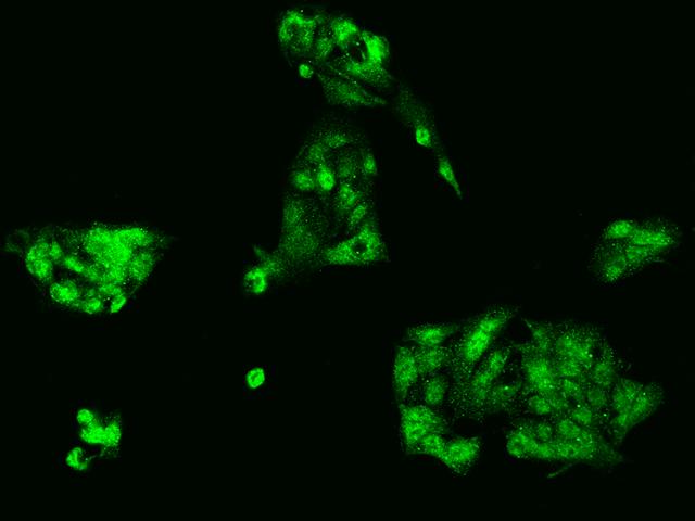 SCARA5 Antibody - Immunofluorescence staining of SCARA5 in HepG2 cells. Cells were fixed with 4% PFA, permeabilzed with 0.1% Triton X-100 in PBS, blocked with 10% serum, and incubated with rabbit anti-Human SCARA5 polyclonal antibody (dilution ratio 1:200) at 4°C overnight. Then cells were stained with the Alexa Fluor 488-conjugated Goat Anti-rabbit IgG secondary antibody (green). Positive staining was localized to Nucleus and Cytoplasm.