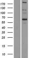 SCARA5 Protein - Western validation with an anti-DDK antibody * L: Control HEK293 lysate R: Over-expression lysate