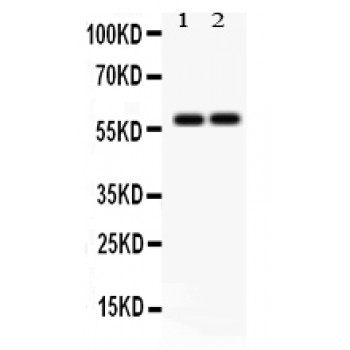 SCARB1 / SR-BI Antibody - SCARB1 antibody Western blot. All lanes: Anti SCARB1 at 0.5 ug/ml. Lane 1: Rat Testis Tissue Lysate at 50 ug. Lane 2: Mouse Testis Tissue Lysate at 50 ug. Predicted band size: 57 kD. Observed band size: 57 kD.