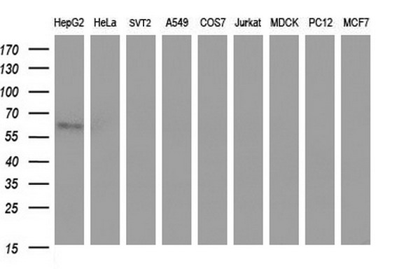 SCARB1 / SR-BI Antibody - Western blot of extracts (35ug) from 9 different cell lines by using anti-SCARB1 monoclonal antibody (HepG2: human; HeLa: human; SVT2: mouse; A549: human; COS7: monkey; Jurkat: human; MDCK: canine; PC12: rat; MCF7: human).