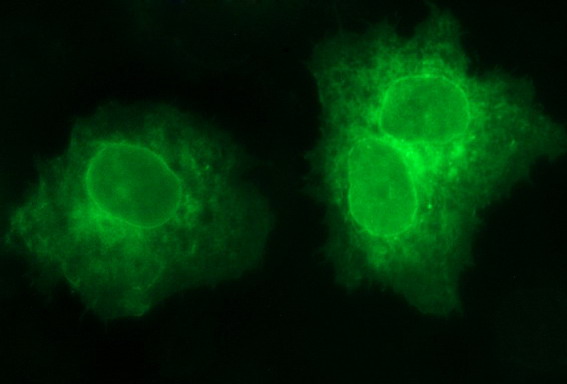 SCARB1 / SR-BI Antibody - Anti-SCARB1 mouse monoclonal antibody immunofluorescent staining of COS7 cells transiently transfected by pCMV6-ENTRY SCARB1.