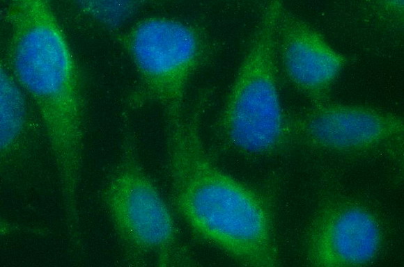 SCARB1 / SR-BI Antibody - Immunofluorescent staining of HeLa cells using anti-SCARB1 mouse monoclonal antibody.