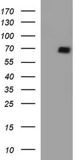 SCARB1 / SR-BI Antibody - HEK293T cells were transfected with the pCMV6-ENTRY control (Left lane) or pCMV6-ENTRY SCARB1 (Right lane) cDNA for 48 hrs and lysed. Equivalent amounts of cell lysates (5 ug per lane) were separated by SDS-PAGE and immunoblotted with anti-SCARB1.