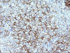 SCARB1 / SR-BI Antibody - IHC of paraffin-embedded Human liver tissue using anti-SCARB1 mouse monoclonal antibody. (Heat-induced epitope retrieval by 10mM citric buffer, pH6.0, 120°C for 3min).